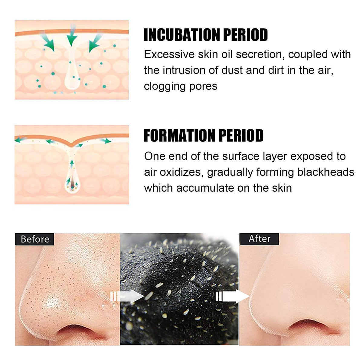 Blackhead Nose Patches 10pc