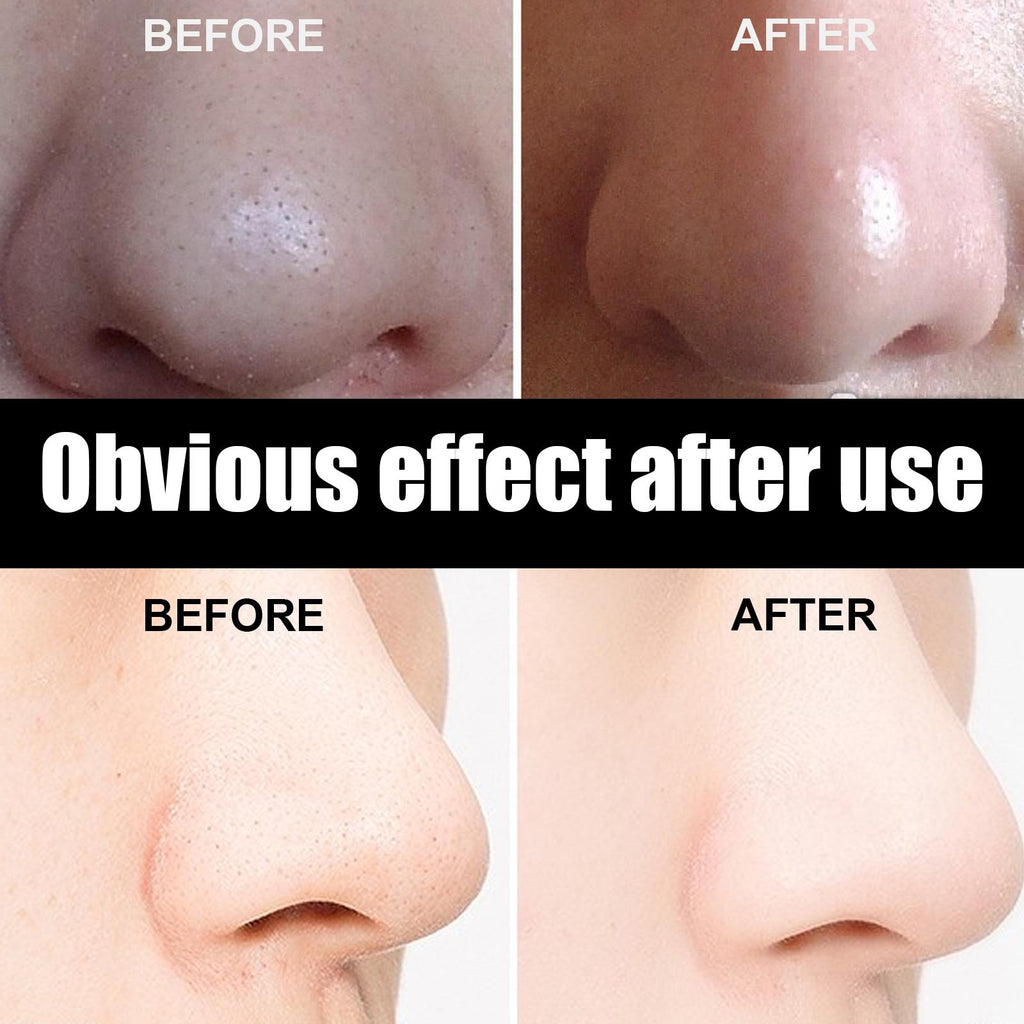 Blackhead Nose Patches 10pc