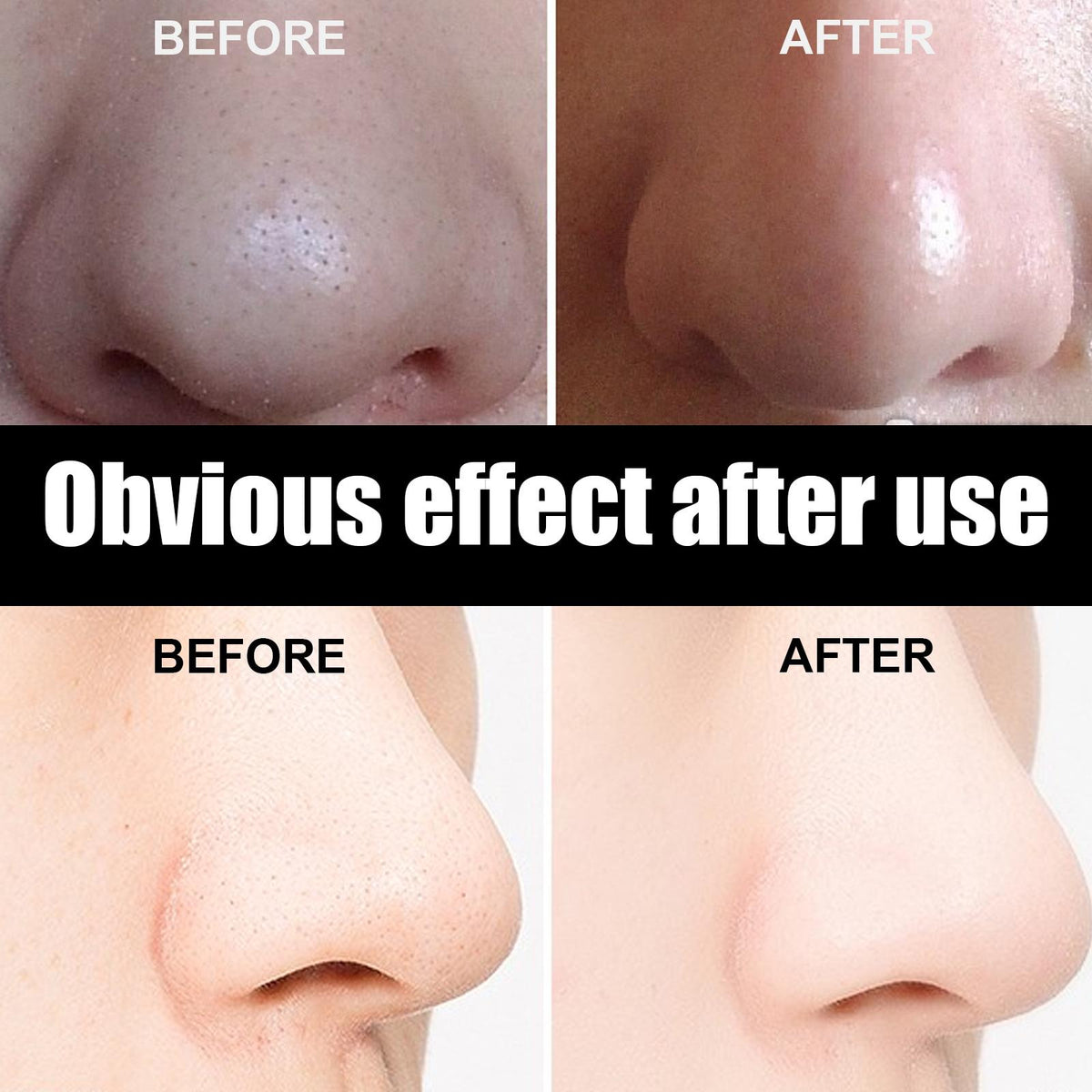 Blackhead Nose Patches 10pc